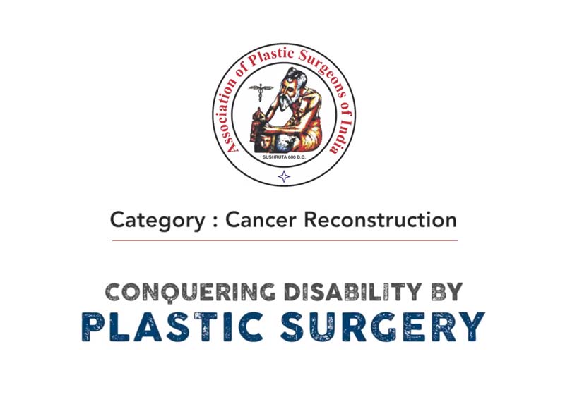 Conquering disability by Plastic Surgery