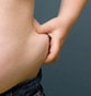 Abdominoplasty